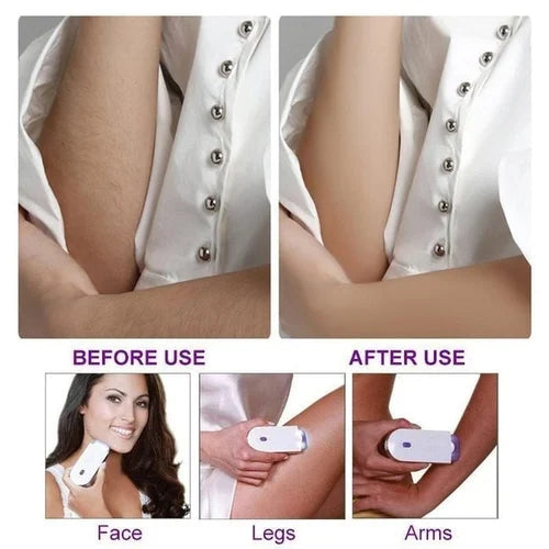 Imported Yes Finishing Touch Hair Removal